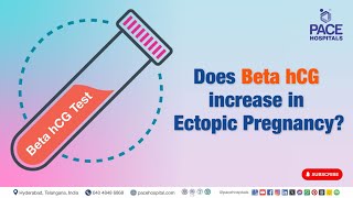 Does Beta HCG increase in Ectopic Pregnancy  ectopicpregnancy [upl. by Erodasi]