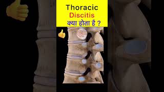 Thoracic discitis क्या है  shorts spine medicalanimation [upl. by Hiasi]