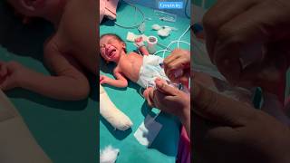 Very Emotional Crying ❤️medical newbornbaby viralvideo [upl. by Adnohsek]