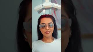 Female Hair Transplant Transformation  Real Hair Loss Solutions at Este Medical [upl. by Beauchamp983]