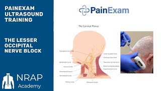 The Ultrasound Guided Lesser Occipital Nerve Block NRAP Academys Ultrasound Course excerpt [upl. by Ailama]