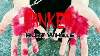 CANKER  Hunt Whale OFFICIAL VIDEO [upl. by Reppiks]