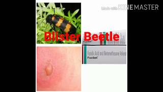 Blister Beetle Bug Bite treatment  How to treat  Prevention Acid fly attack [upl. by Eniroc]