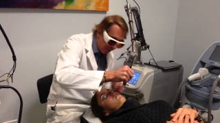 Spectra Carbon Laser Acne Peel Treats and Prevents Acne Dr Weiner Destin Florida [upl. by Gaw507]