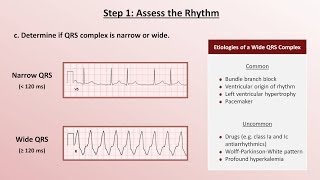 Intro to EKG Interpretation  A Systematic Approach [upl. by Chatav123]