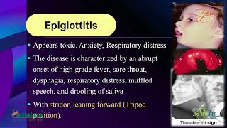 Clinical Approach For Stridor amp Wheezing In Pediatric  Dr Rafat Alkadi [upl. by Akimat364]