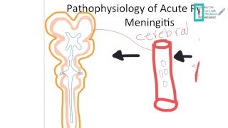 Meningitis Part 1 [upl. by Eelreveb]