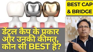 डेंटल कैप के प्रकारउनकी कीमत और कौन सी बेस्ट हैtypes of dental capprice and which one is Best [upl. by Ayarahs]