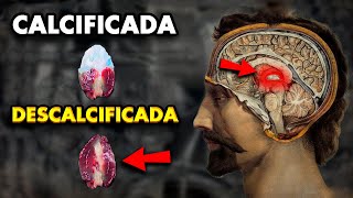 👁️ ASÍ LOGRÉ DESCALCIFICAR MI GLÁNDULA PINEAL  Tercer Ojo [upl. by Thorley]