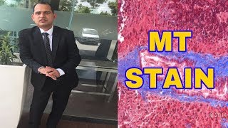 HOW TO DO MT STAIN [upl. by Hoopen479]