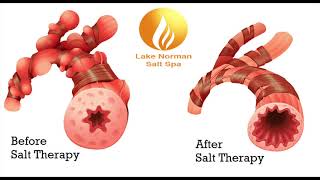 Halotherapy Explained LKNSaltSpa [upl. by Bora]