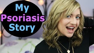 MY PSORIASIS STORY  Psoriasis Treatment Psoriasis Diet Positive Affirmations  Guttate Psoriasis [upl. by Nosneh]