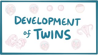 Development of twins [upl. by Hartfield]