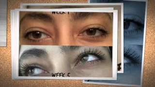 2019 HOW TO GROW ULTRA LONG EYELASHES WITH Careprost BeforeAfter Results Review GENUINE 35 Latisse [upl. by Euqram]