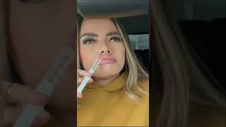 Me inyecte los labios para verme como las Kardashians Reaccion de mi esposo shorts comedia humor [upl. by Ulani]