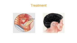 Orofacial pain [upl. by Manville275]