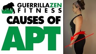 Anterior Pelvic Tilt CAUSES amp Exercises To AVOID [upl. by Grimona281]