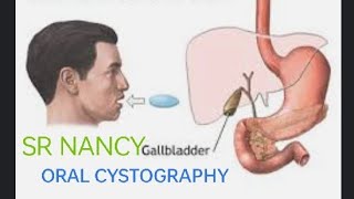 oral cholecystography procedure [upl. by Chasse617]