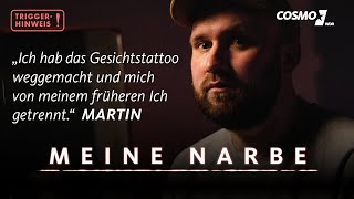 Martin war Häftling in einem syrischen Foltergefängnis  Meine Narbe  COSMO [upl. by Hsemin]