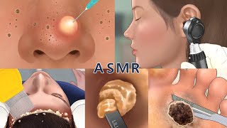 Care Animation Collection 4 no music  nose foot hair ear care  코피지 발사마귀귀청소 머릿니 [upl. by Nastassia]