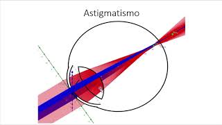 Astigmatismo parte 1 clasificación monocular introducción conoide de Sturm Paradoja astigmática [upl. by Geof]