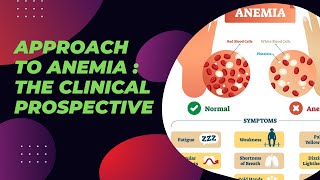 Approach to Anemia  The clinical Prospective [upl. by Rehpotsirc]