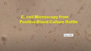 E coli in Wet Mount of Tryptone soy broth [upl. by Nyrrad]