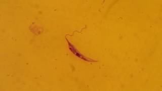 Leishmania donovani promastigote form [upl. by Aleekat]