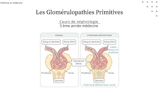 les Glomérulopathies Primitives  LGM HSF GEM maladie de BERGER GNMP GNRP nephro [upl. by Eednus450]