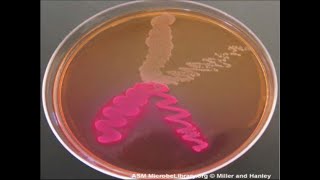 Micro Lab 6 Selective and Differential Media [upl. by Keener]