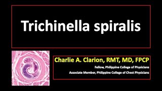 Trichinella spiralis [upl. by Lesab]