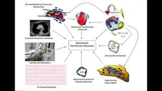 Síndrome de Bajo Gasto Cardiaco Derecho  Definición y Fisiopatología Parte 1 [upl. by Amluz351]