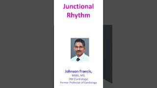 Junctional Rhythm [upl. by Hugibert]