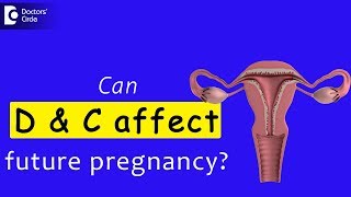 Does Dilatation and curettage Gynecological procedure affect future pregnancyDrSagar Bumb of C9 [upl. by Bogey539]