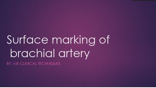 brachial artery surface markingsurface anatomy of brachial artery [upl. by Kcirdled]