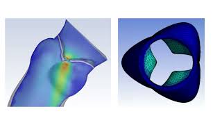 Aortic Valve Displacement CFD Simulation [upl. by Salsbury]