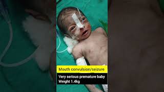 Baby mouth convulsion seizure shorts nicu serious baby [upl. by Haya]