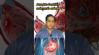 Atrophic Gastritis என்றால் என்ன 😏Atrophic Gastritis symptomsH pylori gastritis gastritis ulcer [upl. by Ecirehc716]