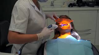 Blanqueamiento dental de Yotuel [upl. by Edana]