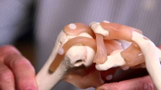 Treating Stiff Joints [upl. by Alika]