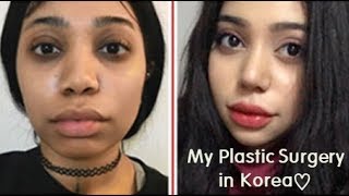 Best Korean Plastic Surgery Clinic Rhinoplasty amp Facial Contouring Surgery Review [upl. by Atiuqan551]