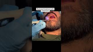 Rotary endodontics  rootcanal prep with rotary files endomotor [upl. by Nesilla83]