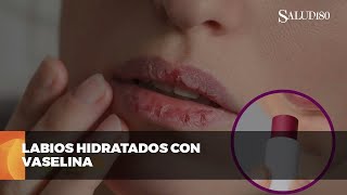 ✅ Protege tus labios del frío  Salud180 🌿 [upl. by Noinatrad291]