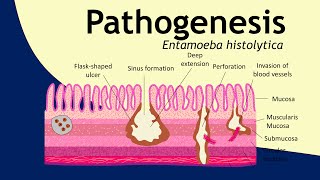 Pathogenesis of Entamoeba histolytica  parasitology  Basic Science Series [upl. by Circosta]