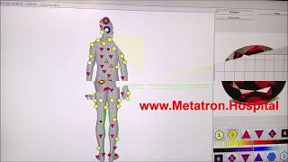 NonLinear Diagnostics Metapathia Hospital Metatron Upgraded By Medicomat Ltd For Remote Mode [upl. by Maisel]