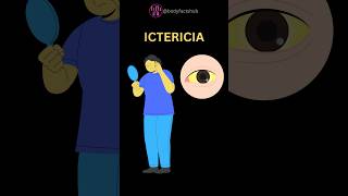 Ictericia ¿Qué es Bilirrubina medicina sabiasque curiosidades interesante culturageneral [upl. by Aldus]