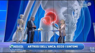 Artrosi allanca i sintomi come riconoscerla Le nuove protesi [upl. by Agnizn]