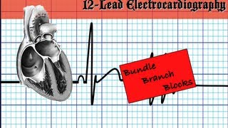 Bundle Branch Blocks  Part 1 [upl. by Hercule]