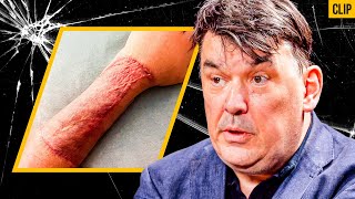 What They HIDE About HORRIFIC Gender Surgeries – Graham Linehan [upl. by Hyacintha815]