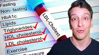 LDL Cholesterol level Your lab results explained [upl. by Nicky]